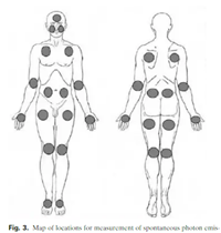 図３
The body locations on the left (l) and right (r) side were ab-breviated as follows : forehead (FHD), cheek (Chk), thorax-anterior (Th-A), thorax-posterior, scapulae (Th-P), abdomen-anterior (Ab-A), abdo-men-posterior, kidneys (Ab-P), elbow-anterior (El-A), elbow-posterior(El-P), hand palm (Ha-p), hand dorsal (Ha-d), upper leg-anterior (Up-A), upper leg-posterior (Up-P), knee (Kne), hollow of knee (HKn), and footfrontal (Fof).