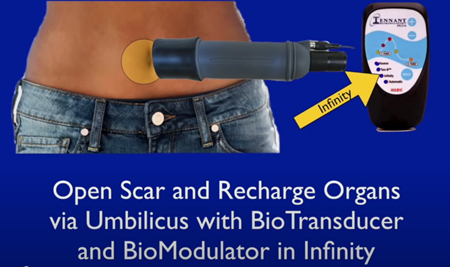 バイオトランスデューサーとバイオモジュレーターを使って、傷口を開き、臍から臓器を充電することができます