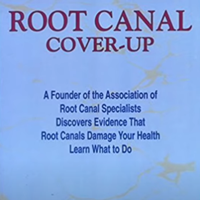 The Root Canal Cover-Up