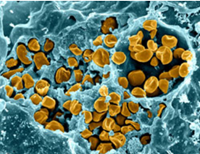 フランシセラ・ツラレンシス（野兎病）は感染力の強い細菌であり、エアロゾル攻撃による兵器化の可能性がある（顕微鏡画像）