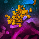 SARS-CoV-2のカラー走査型電子顕微鏡(SEM)画像。 2020年に病気Xを控えた最初のウイルスであると推測されている